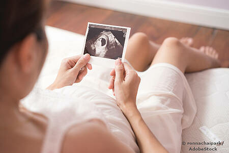 Eine Frau betrachtet das Ultraschallbild ihres ungeborenen Babys. Foto: Ronnachaipark/AdobeStock