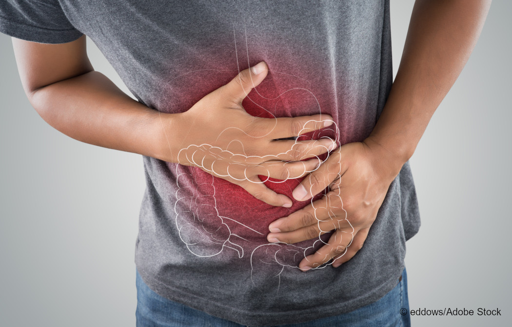 Ein nach vorn gekrümmter Mann hält sich den Bauch. Foto: eddows/AdobeStock